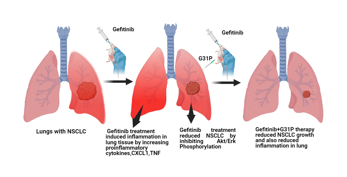 CXCR1 and CXCR2 Antagonism with G31P Attenuates Chemotherapy-Induced Lung Inflammation and Augments the Gefitinib Therapeutic Response in Lung Cancer