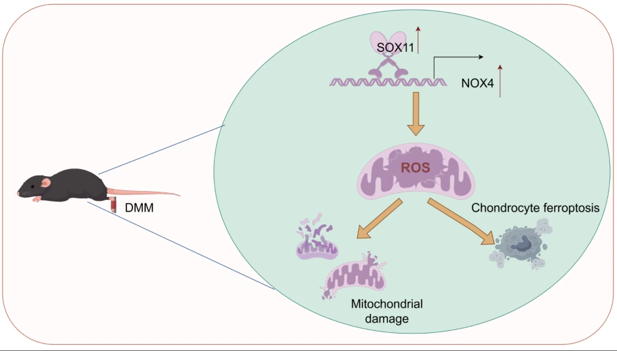 SOX11 Alleviates Osteoarthritis through Reducing Mitochondrial Dysfunction and Ferroptosis via Binding to the Promoter of NOX4