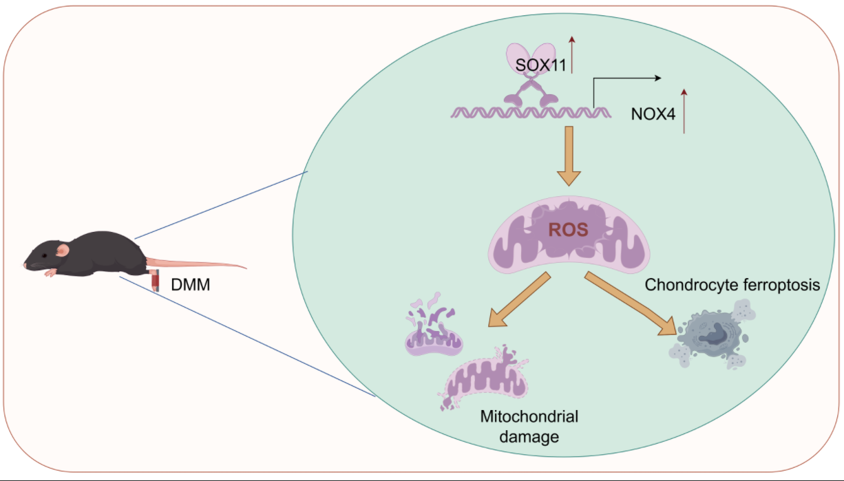 SOX11 Alleviates Osteoarthritis through Reducing Mitochondrial Dysfunction and Ferroptosis via Binding to the Promoter of NOX4