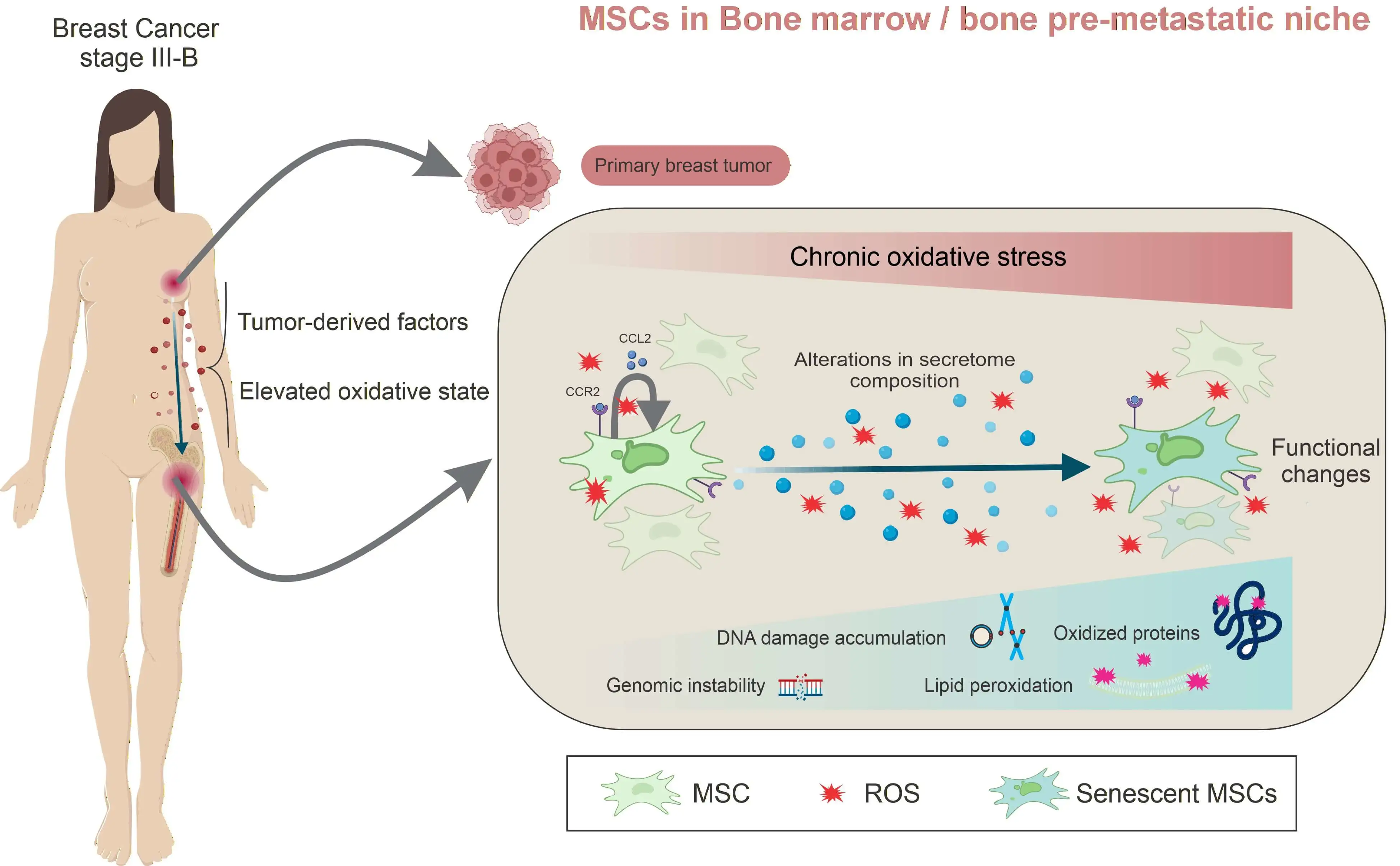 Oxidative Stress Footprints in Bone Marrow Mesenchymal Stem Cells from Untreated Advanced Breast Cancer
