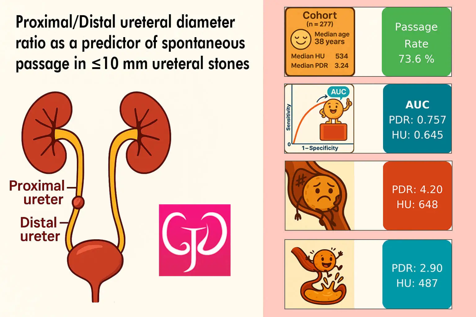 Proximal/Distal ureteral diameter ratio as a predictor of spontaneous passage in <10 mm ureteral stones
