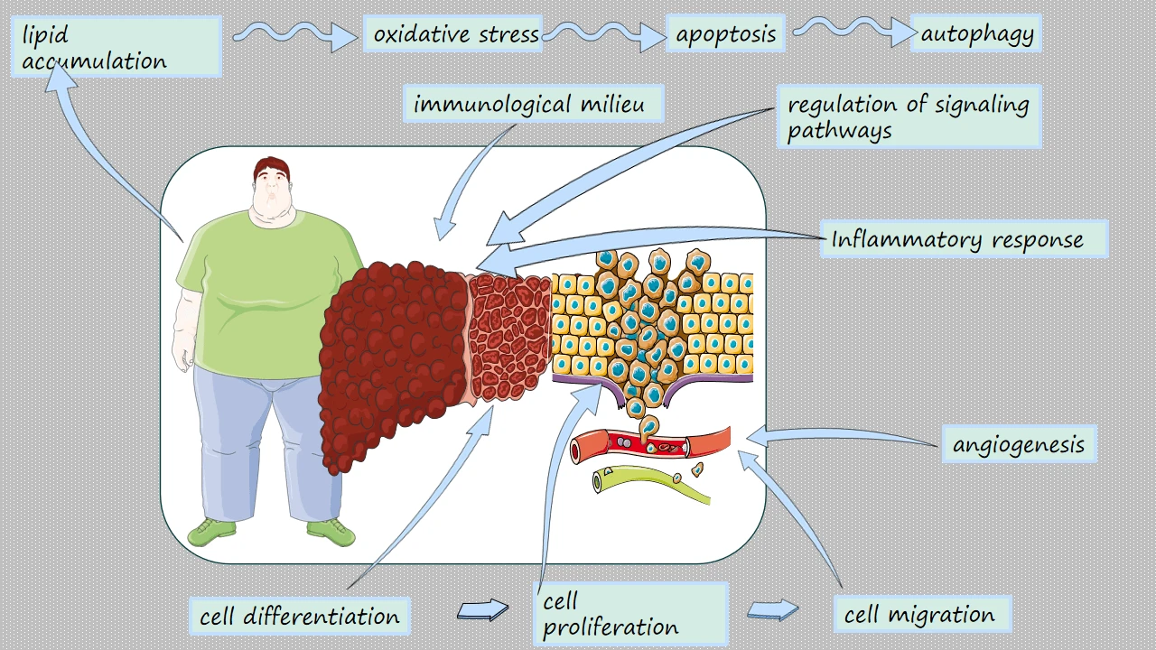 Obesity, Metabolic Dysfunction-Associated Steatotic Liver Disease and Hepatocellular Carcinoma: How Molecular Changes Impact Cellular Functions