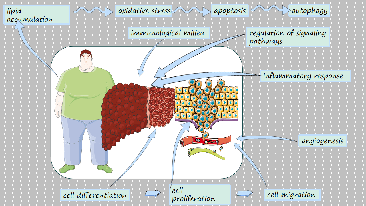 Obesity, Metabolic Dysfunction-Associated Steatotic Liver Disease and Hepatocellular Carcinoma: How Molecular Changes Impact Cellular Functions