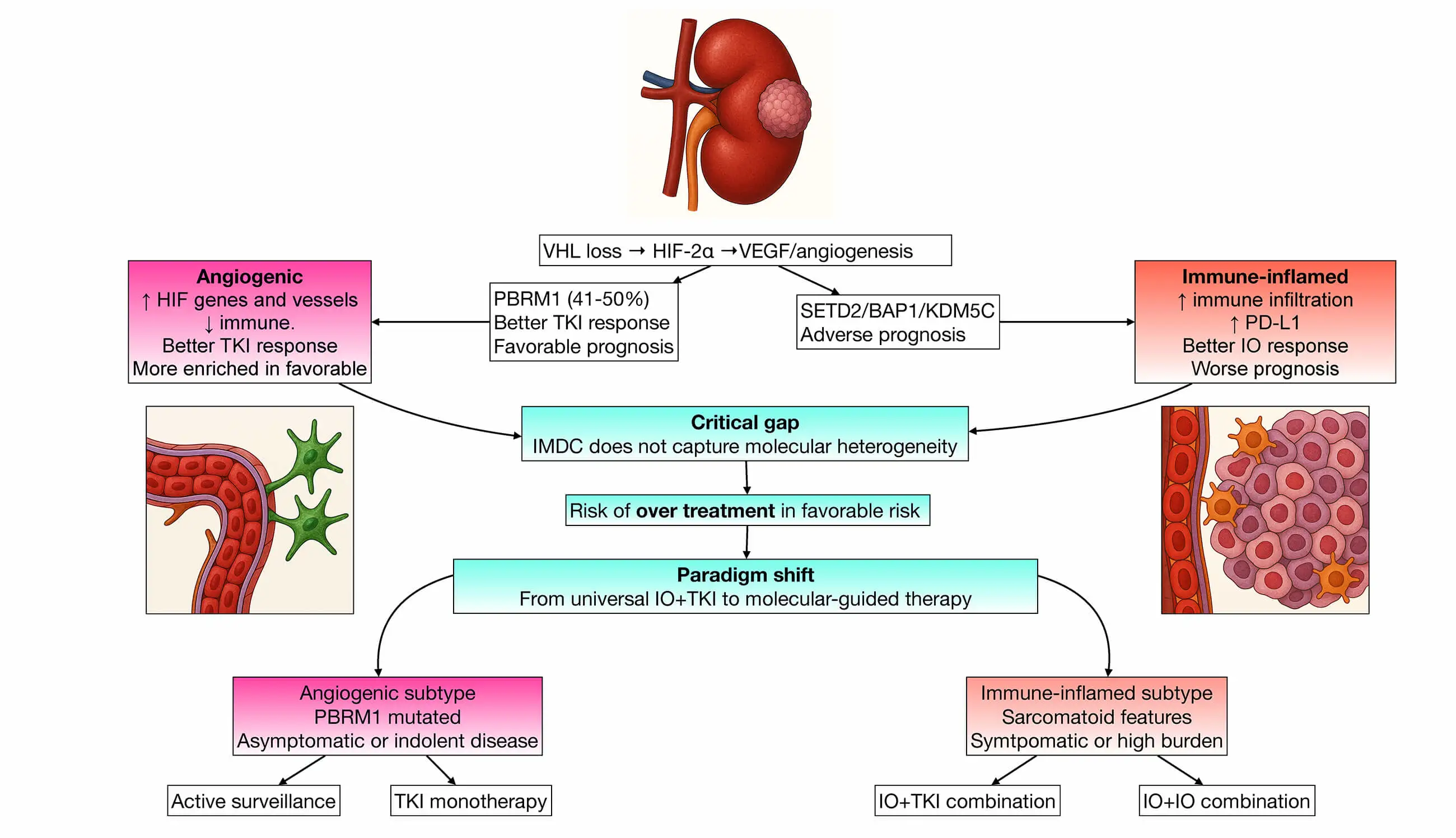 First-Line Treatment Strategies in IMDC Favourable-Risk Metastatic Clear Cell Renal Cell Carcinoma