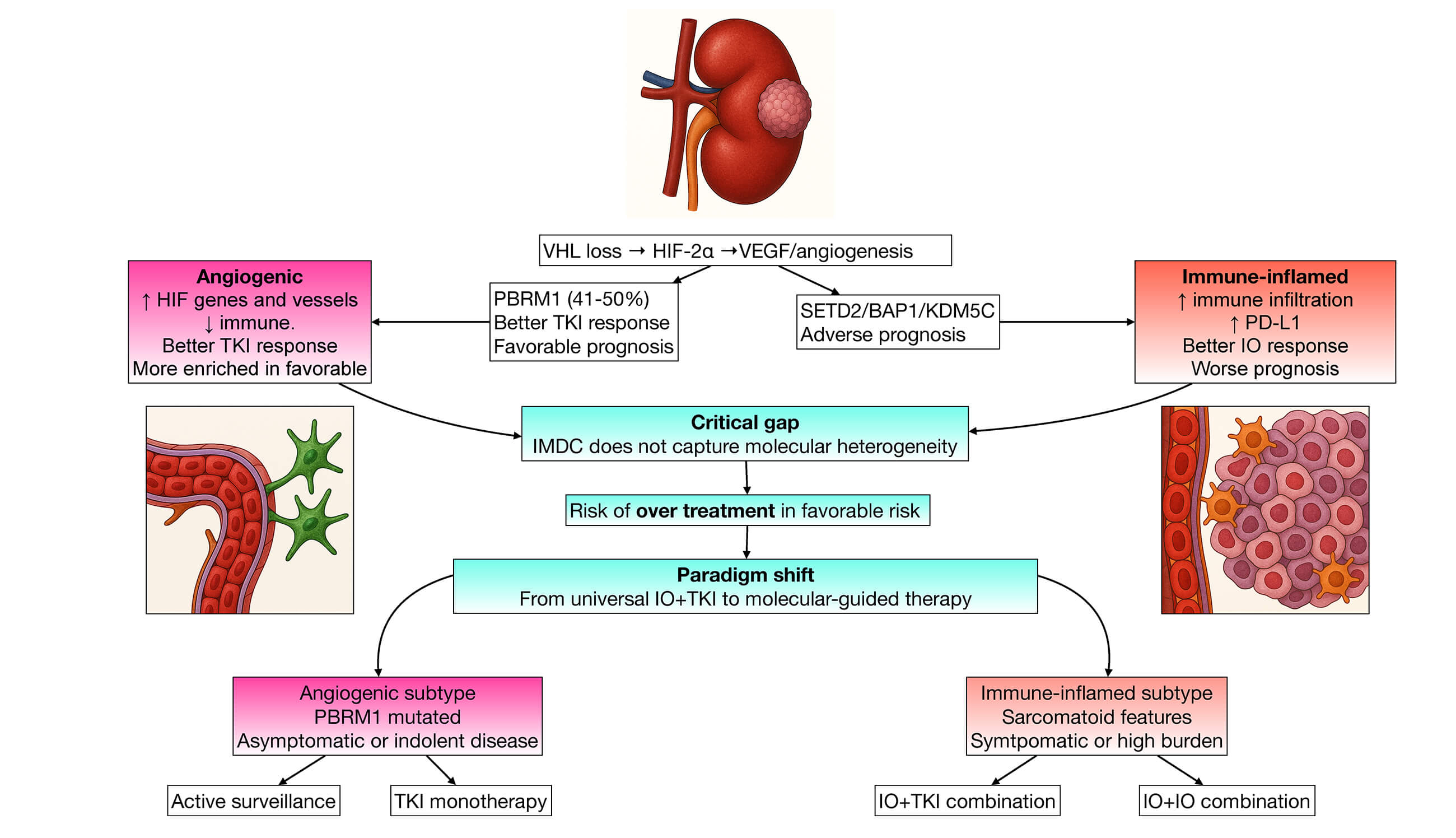 First-Line Treatment Strategies in IMDC Favourable-Risk Metastatic Clear Cell Renal Cell Carcinoma